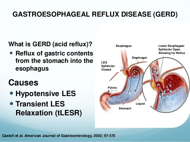 gerd01