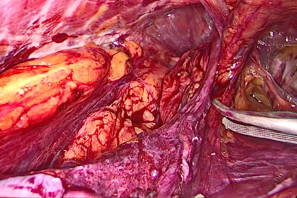 vlcsnap-2023-04-10-12h52m11s995