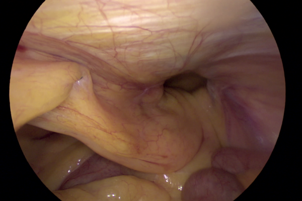 vlcsnap-2023-09-11-12h45m17s751