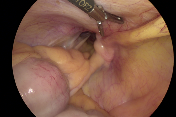 vlcsnap-2023-09-11-12h45m57s725