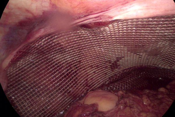 vlcsnap-2023-09-11-12h48m07s199